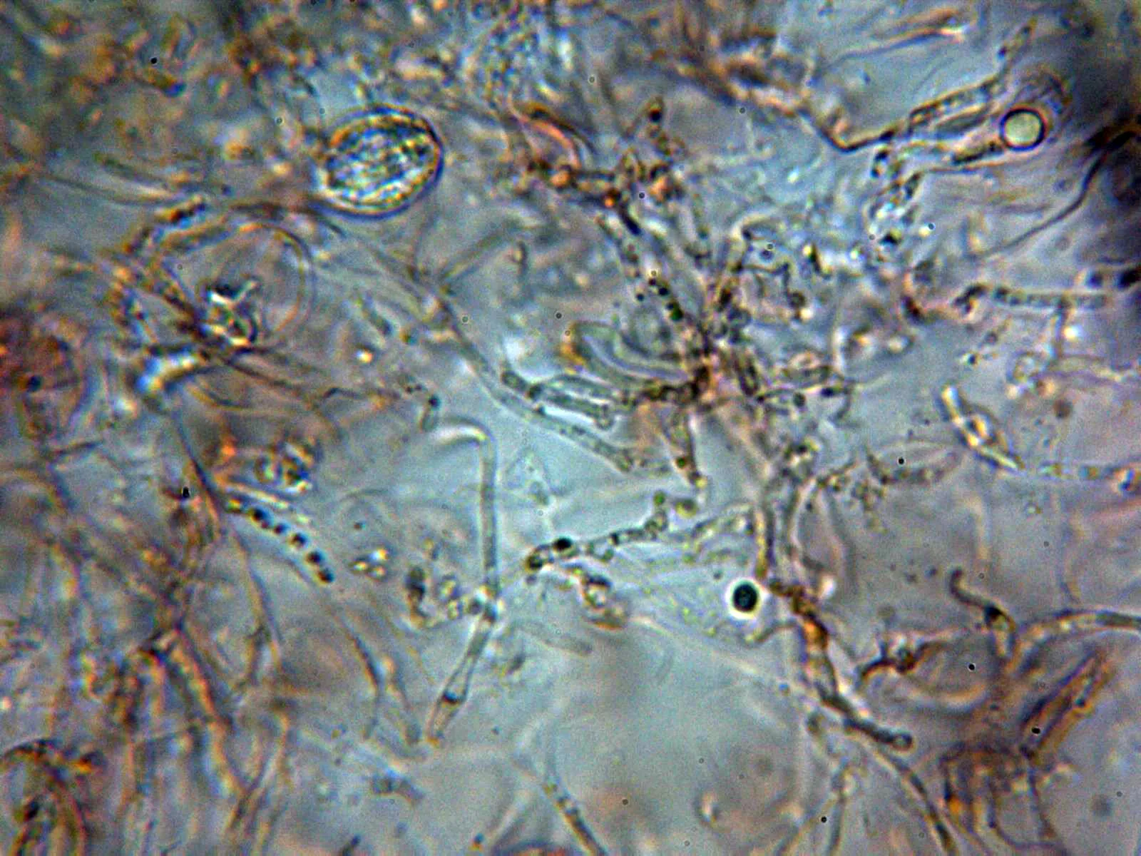 Microscopía de Myxarium nucleatum - 5 - Hifas contexto